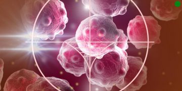 סבלתי מגידול בסחוס – סיפור מרגש שכדאי לקרוא – אורן זריף