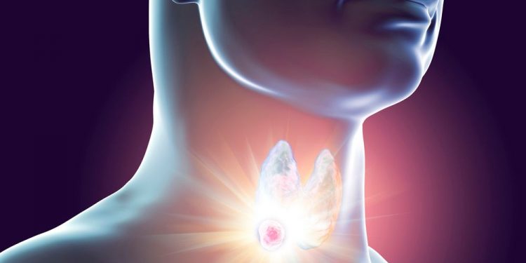 טיפול בבלוטת התריס לסיפור המלא אורן זריף טיפול בפסיכוקנזיס