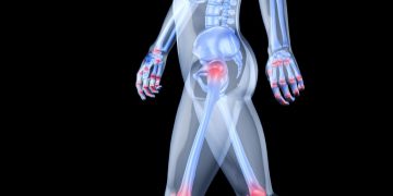 בעיות הליכה סיפור מרגש כדאי לקרוא אורן זריף