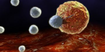 "בזכות אורן זריף הגידול הסרטני בשד הימני נעלם"