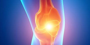 "אנשים לא האמינו שאני הולכת על הרגליים – אורן זריף הציל אותי מניתוח להחלפת ברך"