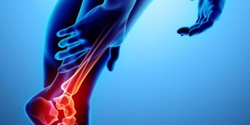 "סבלתי מדלקת בעקב של הרגל ולא יכולתי לעמוד על הרגליים – אורן זריף העלים לי את הבעיה"