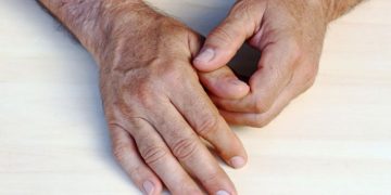 "לא יכולתי להזיז את היד – אחרי 3 טיפולים אצל אורן זריף אני מרגיש טוב"