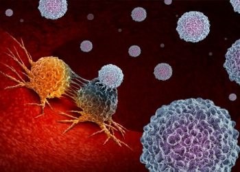 "סבלתי מגידול במח והייתי סקפטית – אורן זריף עזר לי להקטין אותו"