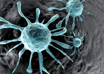 "סבלתי מסרטן בשחלות – הטיפול אצל אורן זריף שיפר את מצבי מפעם לפעם"