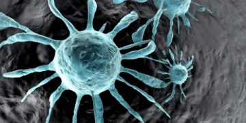 "סבלתי מסרטן בשחלות – הטיפול אצל אורן זריף שיפר את מצבי מפעם לפעם"