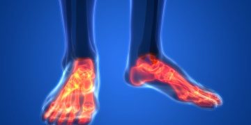 "לא הרגשנו את הרגליים – אורן זריף העלים לנו את הכאבים"