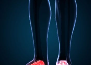 "סבלתי מכאבי רגליים מאוד חזקים והרופאים לא הצליחו לעזור לי – הטיפול אצל אורן זריף עזר לי מיד"