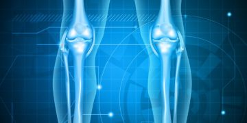 "סבלתי מכאבים בשרירי הרגליים ואורן זריף עזר לי מאוד"