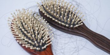 "הייתה לי נשירת שיער איומה – רק אורן זריף הצליח לעזור לי"